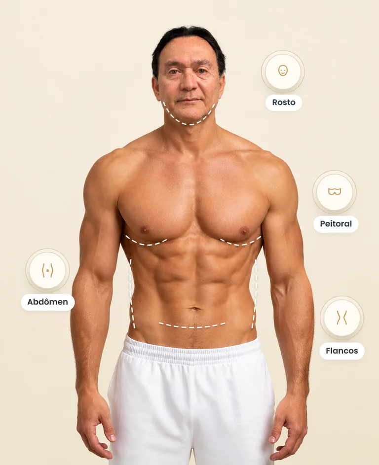 Imagem ilustrativa de um tronco masculino com marcações de planejamento